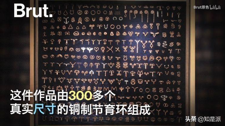 男婴手握节育环出生后续,手握避孕环的胎儿