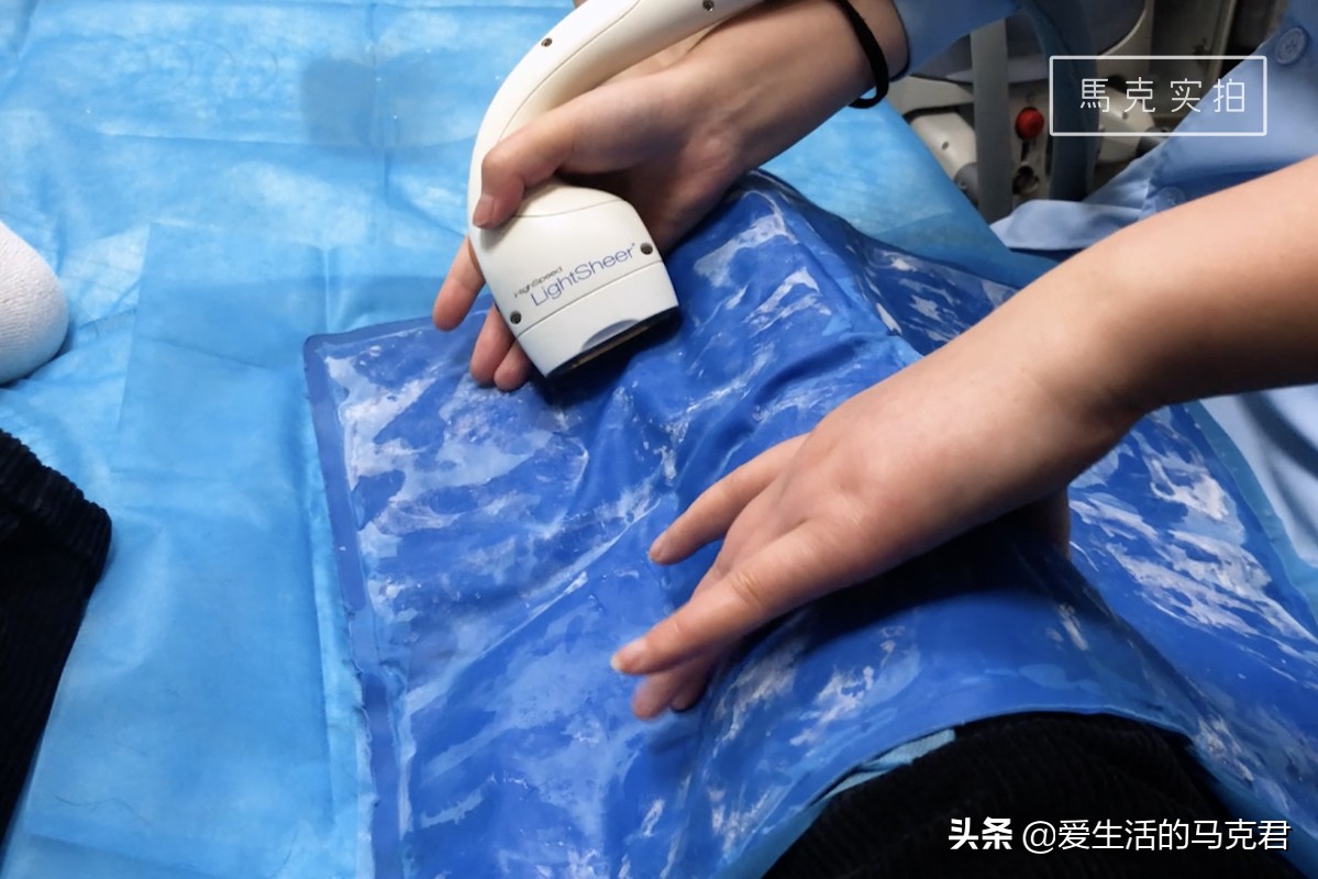 家用脱毛仪哪个牌子脱毛效果最好,家用脱毛仪是不是智商税