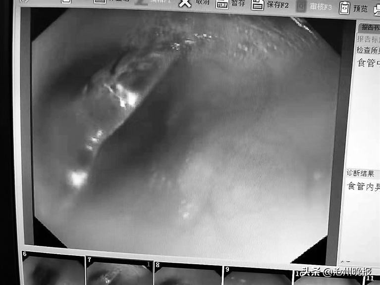 别让孩子玩的危险物品,别让您的家电成为家庭的隐藏杀手