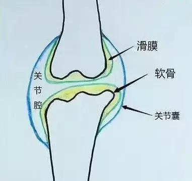 膝关节滑膜炎从何而来？又该如何消除？