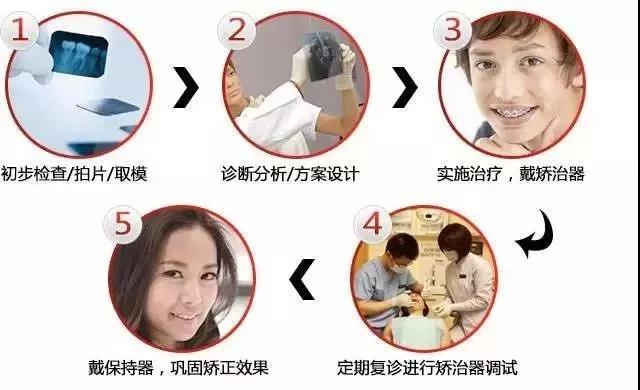 网上几千块牙齿矫正靠谱吗,成人整牙矫正费用