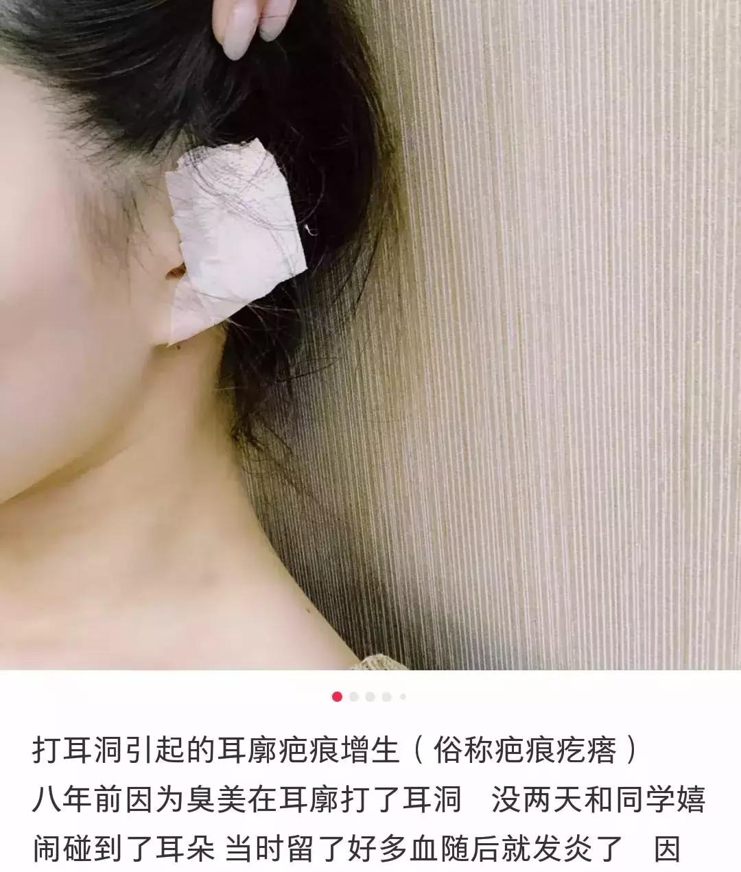 打三个耳洞有什么忌讳,三种人要打耳洞