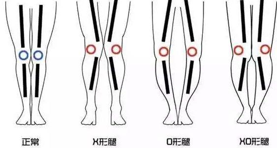 各种腿型适合什么样式的裤子,腿型不好看的适合什么裤子