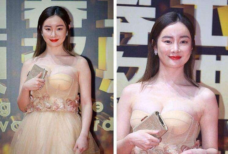 大s注射玻尿酸,大s爆料圈内美女