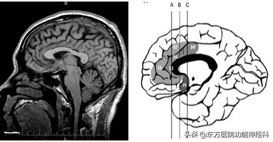 精神病人的前世,精神科药物的前世今生