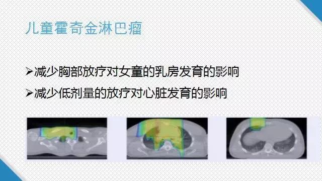 质子治疗适用于什么癌症,质子治疗癌症的疗效咋样