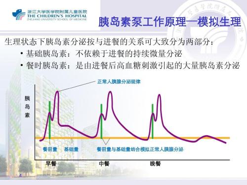 1型糖尿病儿童胰岛素泵使用技巧,胰岛素泵在临床应用介绍