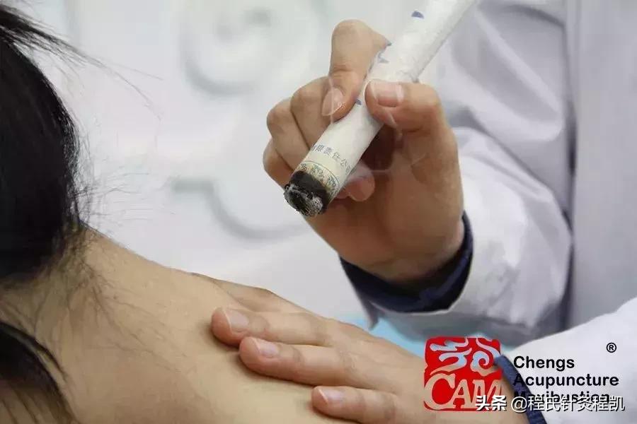 关于艾灸的那些事,答疑解惑揭秘