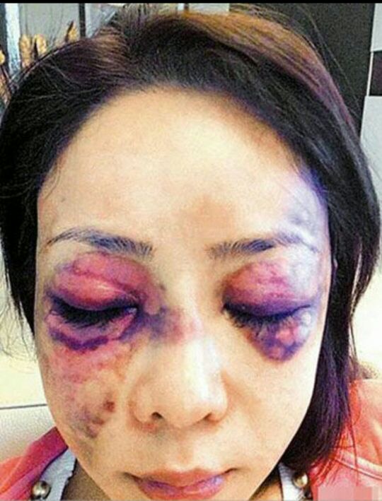 遭夫家频频家暴还能忍？请在腥风血雨来临前，早点断舍离