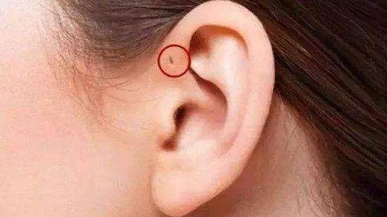 耳仓的危害,耳仓有什么危害