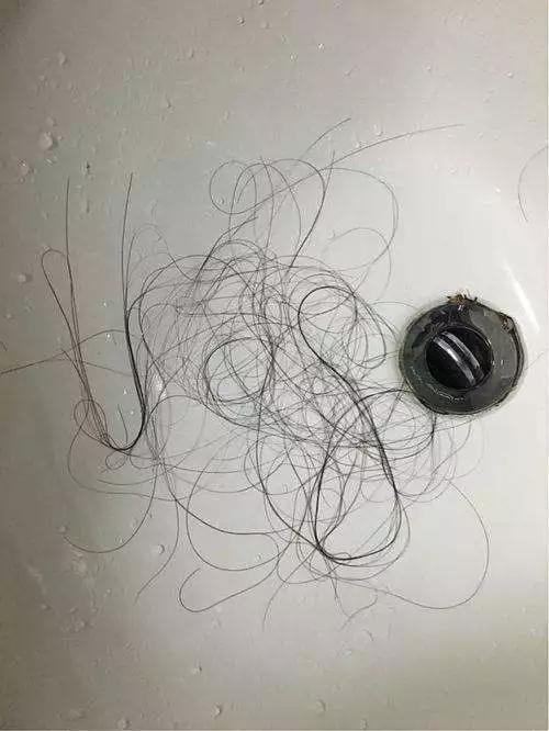 头油头屑痒洗发水,头油头皮屑多脱发洗发水