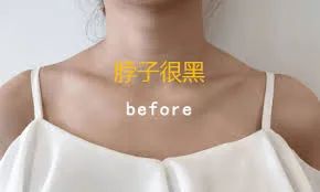 一白遮三丑,这支史上“最便宜”的美白精华,涂全身不肉疼