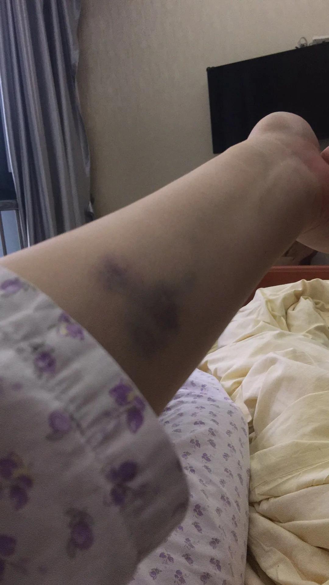 当取卵针戳进我的卵巢,把卵泡一颗颗吸出来时,丈夫在隔壁取精室看片取精|成为母亲