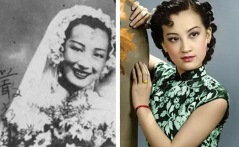 整容医院割单个双眼皮,上海整容医院做双眼皮多少钱