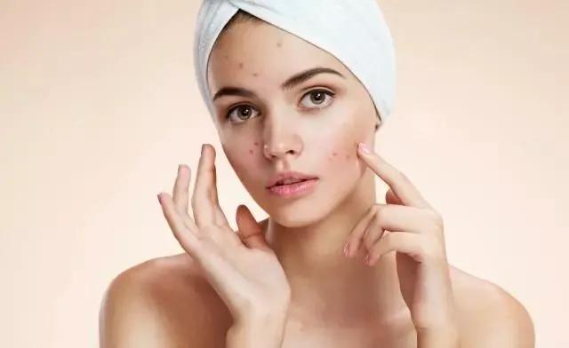 红色痘印和黑色痘印哪个严重,红色痘印和黑色痘印