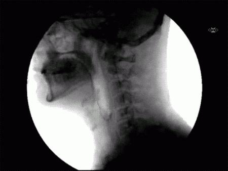 科普张姿势动图:感觉自己姿势又涨了100点