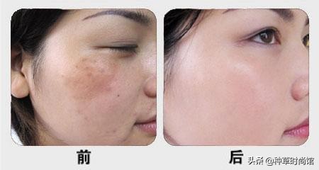 美容养生灌肤,美容灌肤正确方法步骤