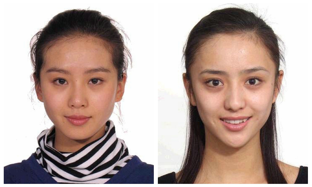 遮黑眼圈和泪沟具体方法和步骤,遮黑眼圈和泪沟的正确使用方法