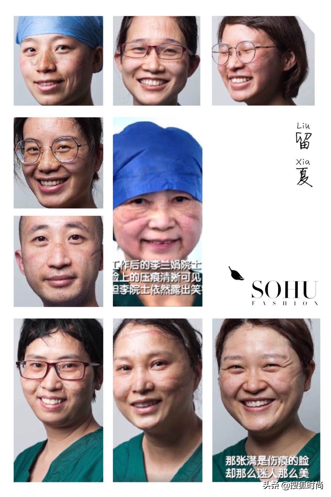 戴口罩起痘、皮肤压伤？关于非常时期的10个皮肤问题一次性解决