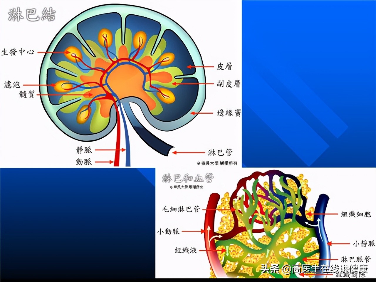 几个月内形成的浸润癌易复发么,浸润癌恶性