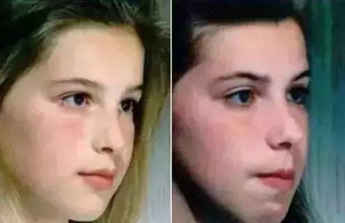 鼾声如雷一个办法就解决了,鼾声如雷怎么治疗