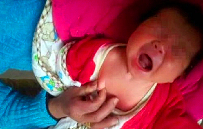 19岁少女乳头一直没长出来,不要听信“老人言”,这种错误犯不得