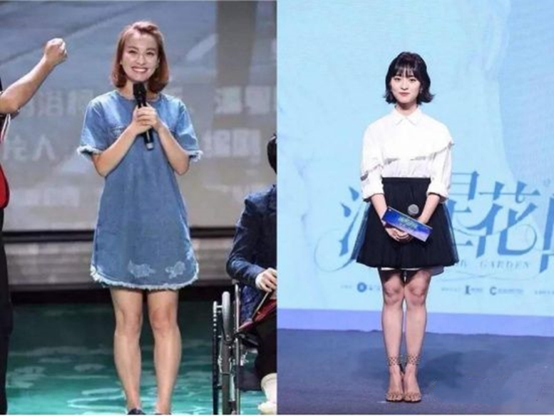 女性腰腹吸脂手术全过程,肥胖的人可以吸脂减肥吗