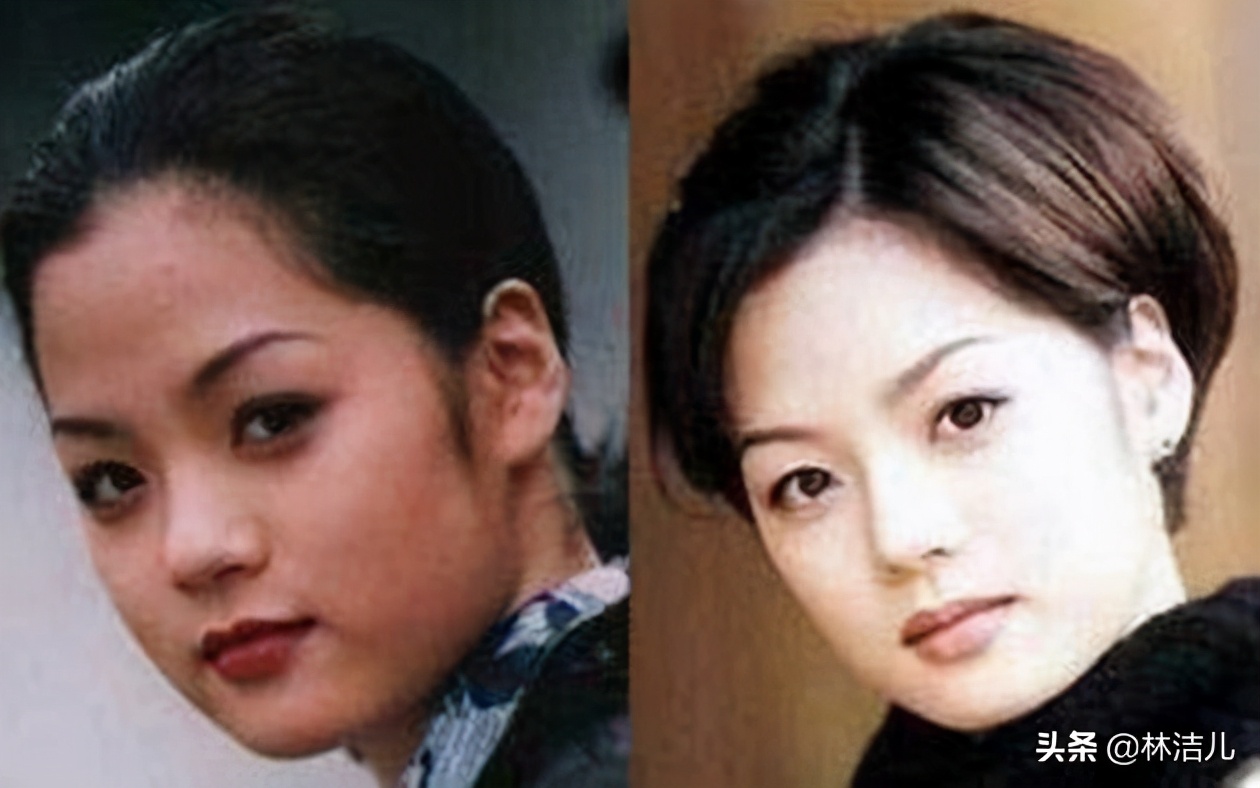 杨紫脸型变美,杨紫鼻基底前后对比