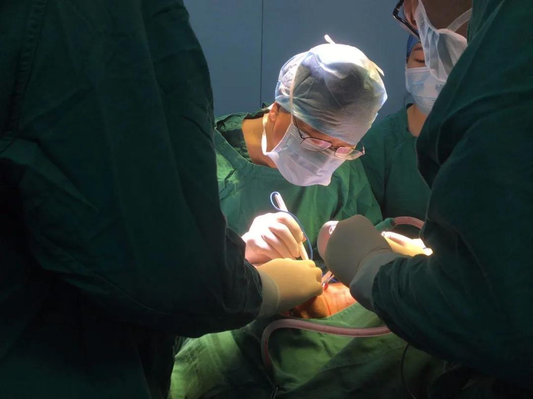 张志愿院士海南,张志愿院士最新视频