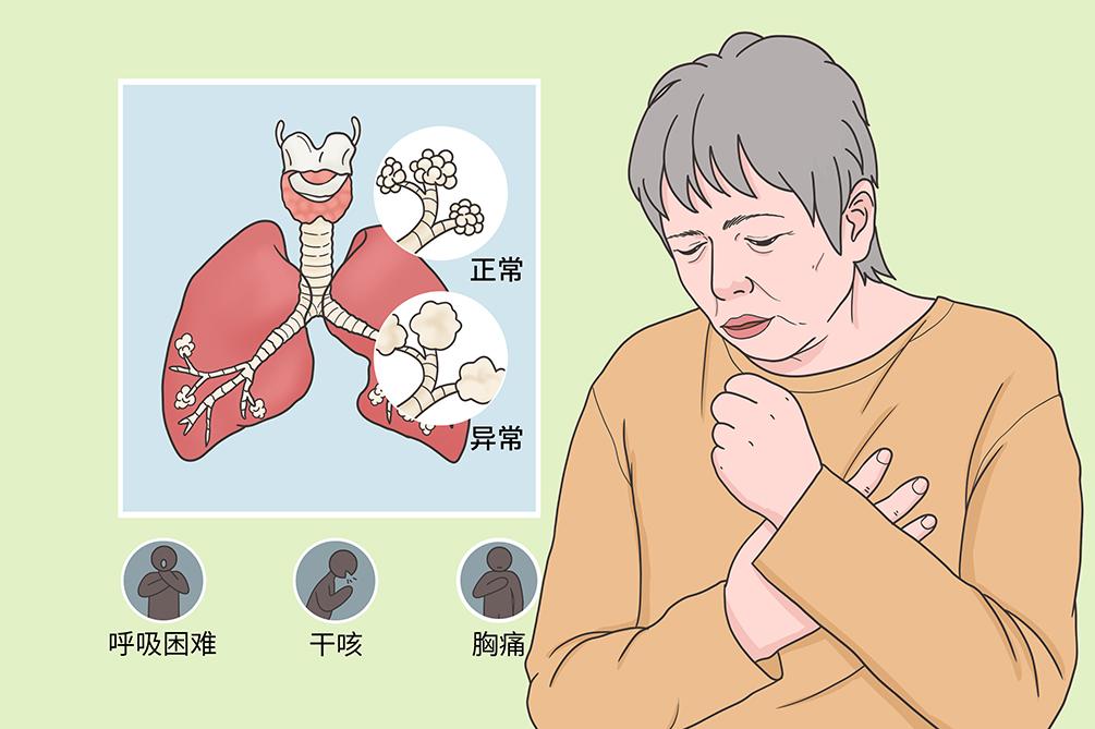 靶向药物引起腹泻中医治疗,靶向药所致腹泻