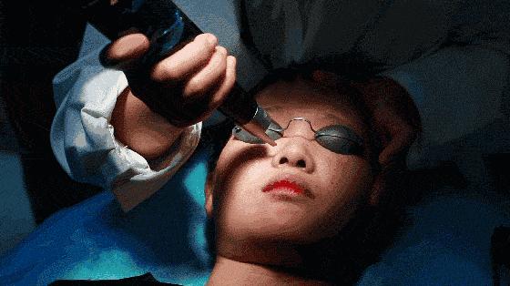 西安激光皮肤美白祛斑,激光皮秒祛斑真的有用吗