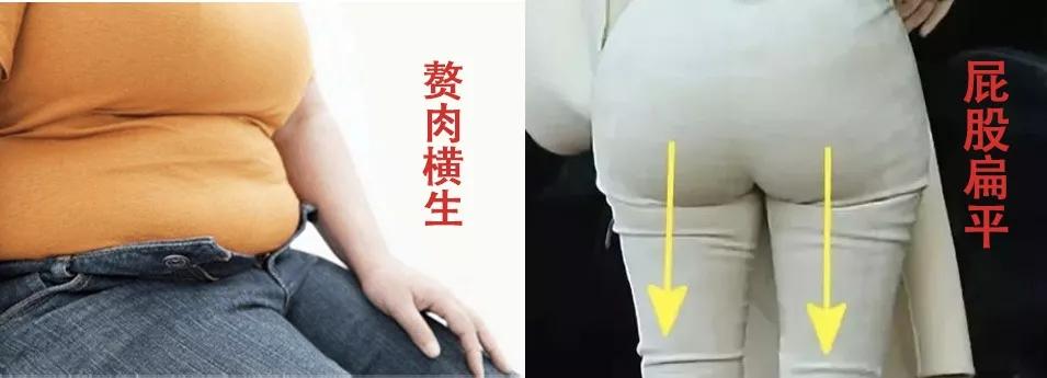 怎么快速解决久坐臀部疼,如何缓解久坐屁股变形