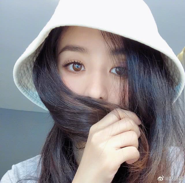赵丽颖眼睛发炎挡头发却成了经典,赵丽颖眼睛发炎出席活动图片