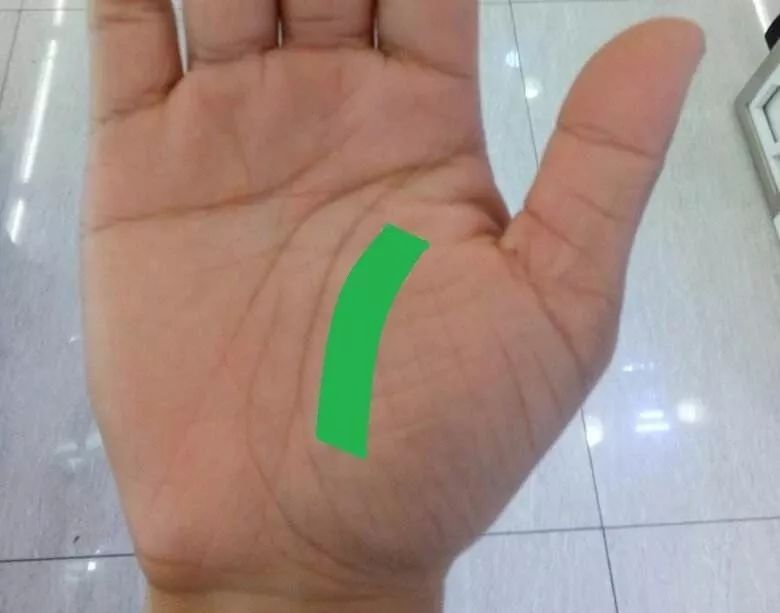 手诊10种常见病从手上就能看出来,手形看健康