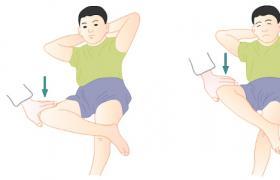 髋关节滑膜炎中药方,髋关节滑膜炎儿童