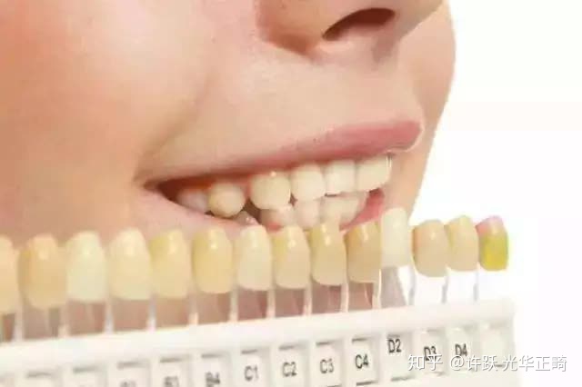 口红和牙齿,口红cp