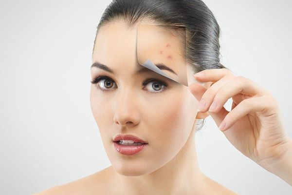 简单有效的去粉刺方法，助力小仙女们轻松告别粉刺烦恼