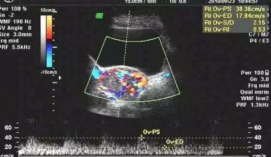 孕妇在葡萄架子下呆着不好吗,孕妇坐葡萄树下不好吗