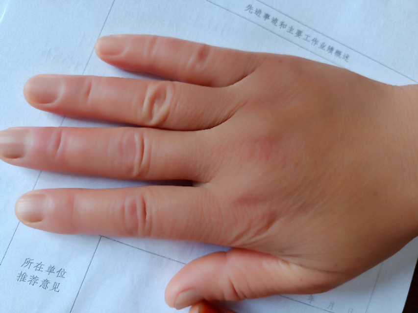 复杂场景头晕,复杂场合就感觉头晕