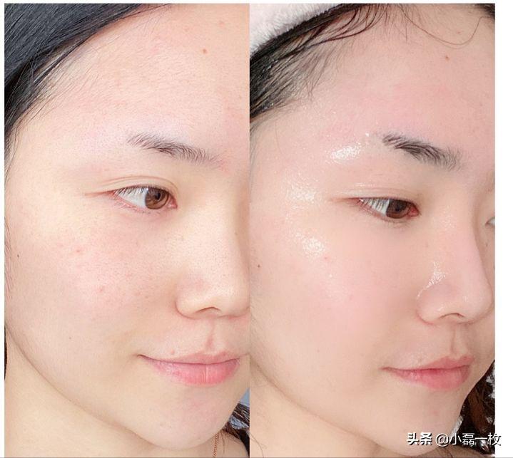 熬夜脸蜡黄暗沉怎么调理,经常熬夜脸色蜡黄喝什么汤水调理