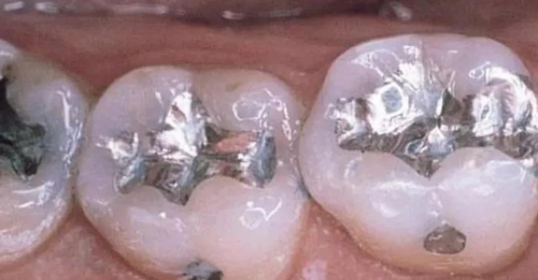 宝宝才三岁牙都坏了咋办,宝宝快三岁了牙齿才16颗