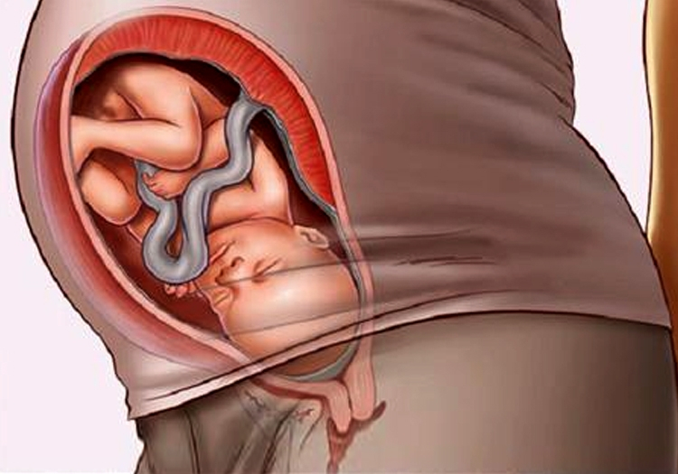 孕妈在孕晚期如果有这6种情况，大多胎儿已经入盆，孕妈莫忽视