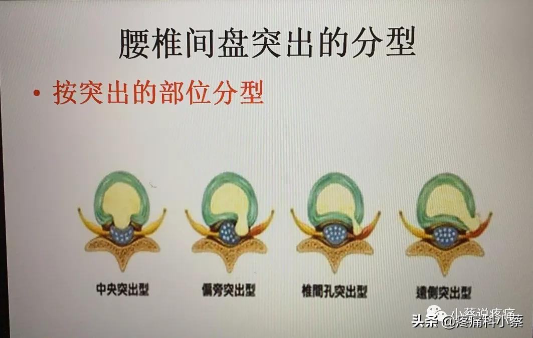 蔡主任讲座视频,蔡主任团队