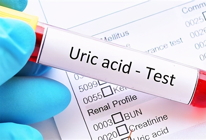 非布司他、别嘌醇和苯溴马隆都降尿酸,有啥区别?医生为您讲清楚