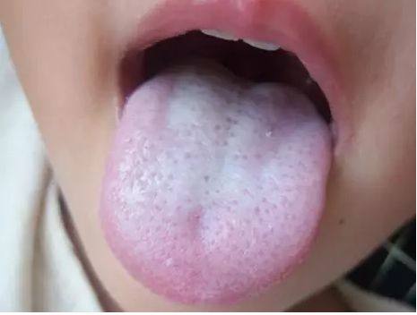 小孩腹泻一招就搞定,孩子半夜腹泻一招就搞定