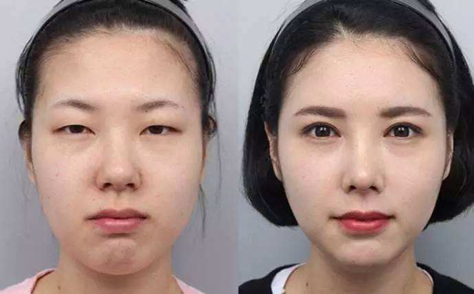 适合内双的隐形双眼皮贴测评,双眼皮专用的双眼皮贴真实测评