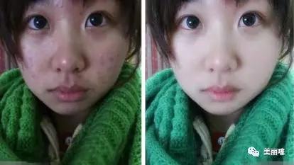 改善毛孔粗大的老牌国货,细化毛孔美白大牌测评