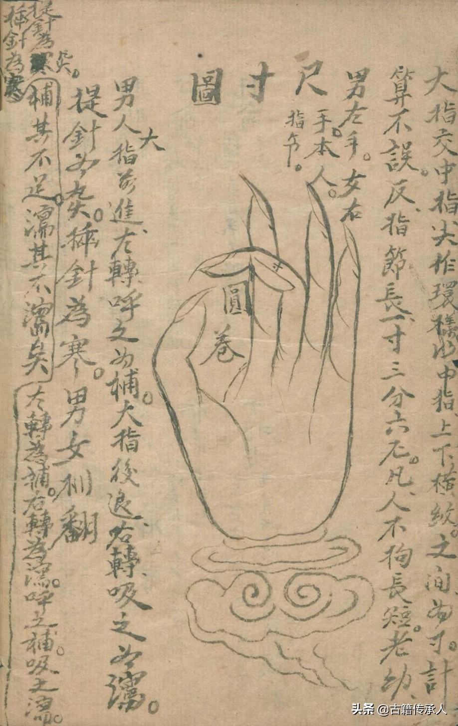 中医针刺放血疗法书,中医古籍阴阳针