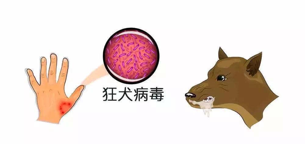 致死率100%的狂犬病,致死率100%的狂犬病误区