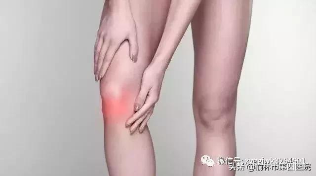 膝关节积液水肿最好的处理方式,膝关节积液解决最好办法